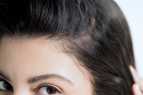 What to Avoid If you Have Thinning Hair