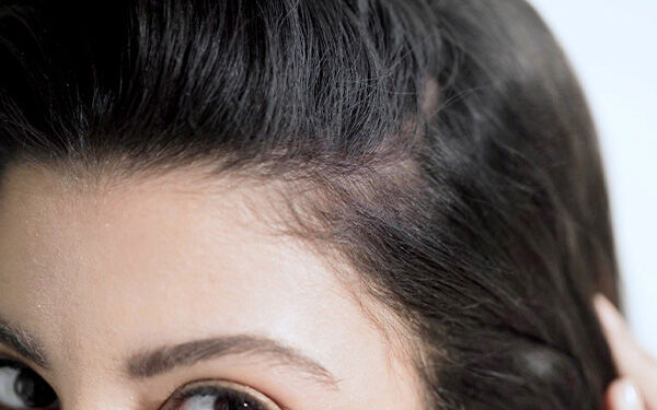 What to Avoid for Thinning Hair