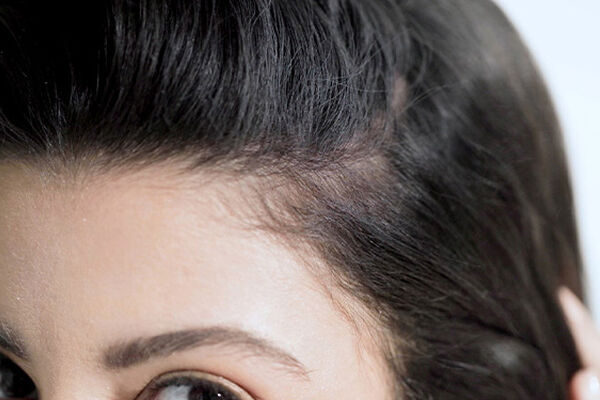 What to Avoid for Thinning Hair